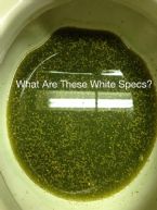 What Are These Thousands Of White Specks In Toilet?