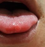 bump tip of tounge ... (Click to enlarge)