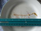 Possible Parasite size pic 3/3