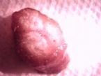 parasite cyst ... (Click to enlarge)