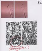 blow up of plate c strongyloides