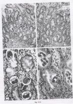 textbook strongyloides eggs larva parasite ... (Click to enlarge)