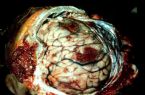 Animal Brain infected with worms/parasites