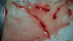 ropeworm_blood_from_cyst