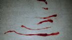 ropeworm_blood