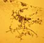 Dust NM Morgellons