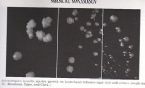 actinomyces israeli