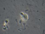 possible coccidian oocyst