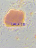 Gut protozoan