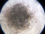 027 fibers from scalp ... (Click to enlarge)