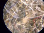 040 scalp fibers