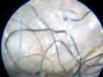 0421fibers from scalp