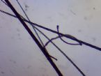 Parasite on dog hair