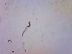 Parasite on dog hair