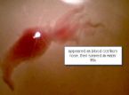 from nose as blood clot - rinsed in water ... (Click to enlarge)