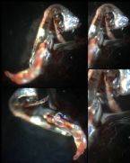 Skin Parasite Microscopic Photo Flatworm Platyhelminth Fluke Larvae? ... (Click to enlarge)