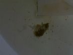 unknown parasite in stool?