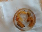 Unidentified in stool soaked in alcohol. Can you help identify??