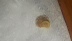 20210501 213015 parasite worm egg or sac