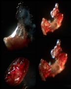 Skin Parasite Infection Microscopic Photos Flatworm Larvae Eggs Platyhelminth Fluke What is This?! ... (Click to enlarge)