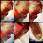 Skin Parasite Larvae Growth Sequence Microscopic Photographs Biofilm ... (Click to enlarge)