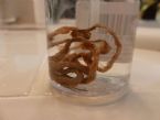 Intestinal Roundworms