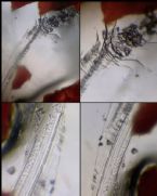 Cutaneous Parasite Platyhelminth ascricis Flat Worm Demodex ... (Click to enlarge)