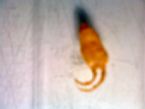 1.5cm long parasite