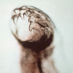 Hookworm NCSUVetSchool ... (Click to enlarge)