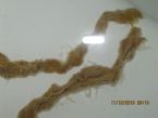 Need identity of intestinal parasite - Image 3 ... (Click to enlarge)