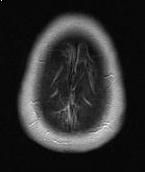 MRI Jun08 20026