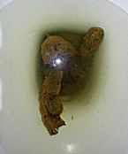 Possible parasites in poop HD ... (Click to enlarge)