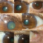 EYE can see ... this aint normal! ... (Click to enlarge)