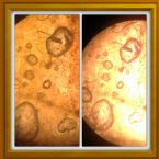 Possible liver eggs/flukes after 4days of Albenza, Ivermectin, Docycycline, & Praziquantel