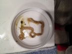 Coffee enema worms