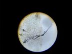 morgellons male female ... (Click to enlarge)