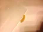 Parasite in bowel?