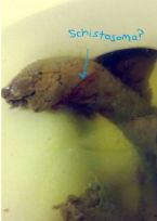 Blood flukes schistosoma in poop ... (Click to enlarge)