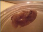 unknown parasite found in stool 2 ... (Click to enlarge)