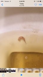 parasite found in urine!