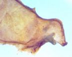 Unidentified Trematode