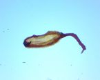 Unidentified Trematode