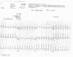 heart test 001 ... (Click to enlarge)