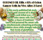 Coconut Oil and Cancer