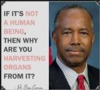 BenCarson HumanOrganHarvest 1 