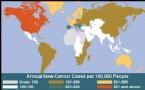 cancer incidence