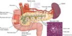 Type 1 Diabetic due to insulin not generated in pancreas