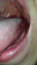 Whats wrong with my tongue ... (Click to enlarge)