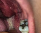 Worms in my throat???? image36 ... (Click to enlarge)