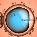 IVF treatment in Delhi